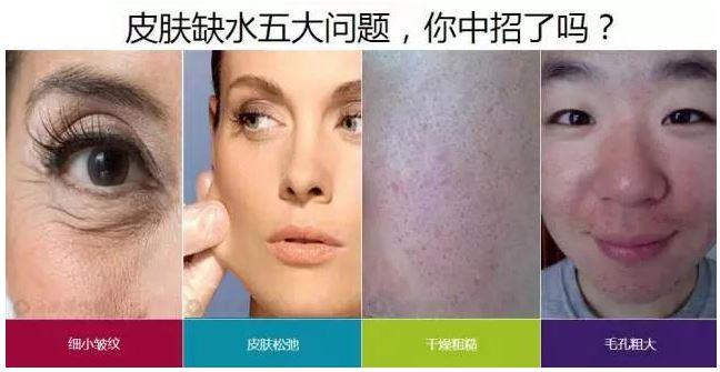 德国无创水光 诗妍丽让你做水美人